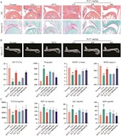 张艺研究员团队在Phytomedicine发表传统藏药二十五味驴血丸改善类风湿性关节炎新机制的研究成果   