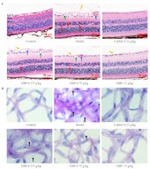 孟宪丽教授团队在Journal of Ethnopharmacology期刊发表藏药小檗皮改善  糖尿病视网膜疾病新机制的研究成果