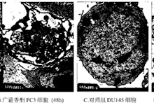 *广藿香酮及其衍生物的用途（彭成）